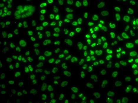 ICC/IF analysis of U2OS cells using GTX33047 BUB3 antibody.