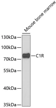 WB analysis of mouse bone marrow tissue lysate using GTX33049 C1R antibody. The signal was developed with ECL plus-Enhanced. Dilution : 1:1000 Loading : 25microg per lane WB analysis of mouse bone marrow tissue lysate using GTX33049 C1R antibody. The signal was developed with ECL plus-Enhanced. Dilution : 1:1000 Loading : 25microg per lane