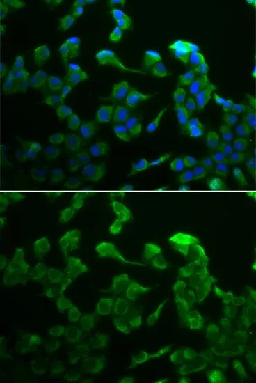 ICC/IF analysis of HeLa cells using GTX33049 C1R antibody. Blue : DAPI