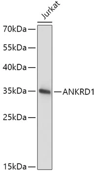 WB analysis of Jurkat cell lysate using GTX33062 CARP antibody. Dilution : 1:1000 Loading : 25microg per lane WB analysis of Jurkat cell lysate using GTX33062 CARP antibody. Dilution : 1:1000 Loading : 25microg per lane