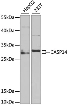 WB analysis of various sample lysates using GTX33063 Caspase 14 antibody. Dilution : 1:1000 Loading : 25microg per lane WB analysis of various sample lysates using GTX33063 Caspase 14 antibody. Dilution : 1:1000 Loading : 25microg per lane