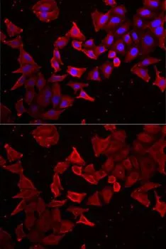 ICC/IF analysis of MCF7 cells using GTX33063 Caspase 14 antibody. Blue : DAPI