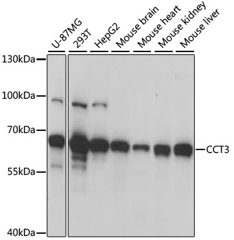 WB analysis of various sample lysates using GTX33073 TCP1 gamma antibody. Dilution : 1:1000 Loading : 25microg per lane WB analysis of various sample lysates using GTX33073 TCP1 gamma antibody. Dilution : 1:1000 Loading : 25microg per lane