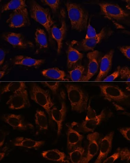 ICC/IF analysis of U2OS cells using GTX33073 TCP1 gamma antibody. Blue : DAPI Dilution : 1:100