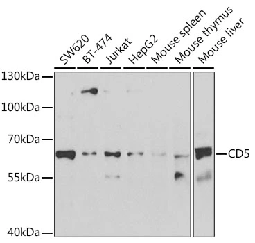 WB analysis of various sample lysates using GTX33079 CD5 antibody. Dilution : 1:1000 Loading : 25microg per lane WB analysis of various sample lysates using GTX33079 CD5 antibody. Dilution : 1:1000 Loading : 25microg per lane