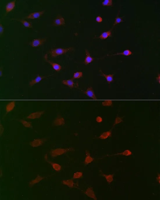 ICC/IF analysis of HeLa cells using GTX33081 CDC34 antibody.