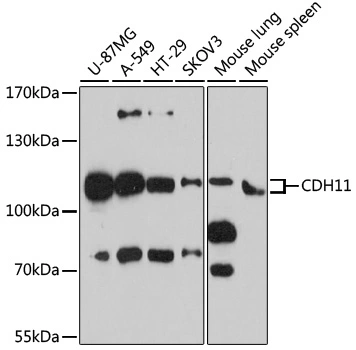 WB analysis of various sample lysates using GTX33082 CDH11 antibody. Dilution : 1:3000 Loading : 25microg per lane WB analysis of various sample lysates using GTX33082 CDH11 antibody. Dilution : 1:3000 Loading : 25microg per lane
