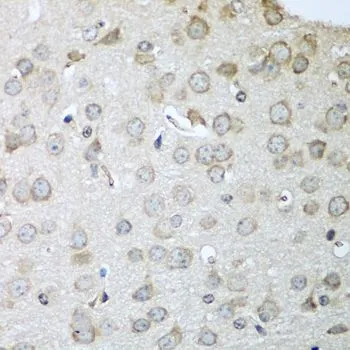 IHC-P analysis of mouse brain tissue using GTX33082 CDH11 antibody. Dilution : 1:100