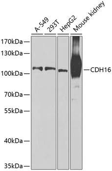WB analysis of various sample lysates using GTX33083 CDH16 antibody. Dilution : 1:1000 Loading : 25microg per lane WB analysis of various sample lysates using GTX33083 CDH16 antibody. Dilution : 1:1000 Loading : 25microg per lane