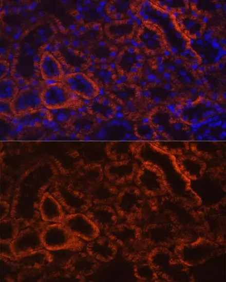 IHC-P analysis of rat kidney tissue using GTX33083 CDH16 antibody. Blue : DAPI Dilution : 1:100