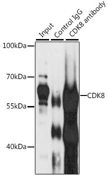 IP analysis of Jurkat cell lysate using GTX33086 CDK8 antibody. Antibody amount : 3microg / 200microg lysate Dilution : 1:1000 IP analysis of Jurkat cell lysate using GTX33086 CDK8 antibody. Antibody amount : 3microg / 200microg lysate Dilution : 1:1000