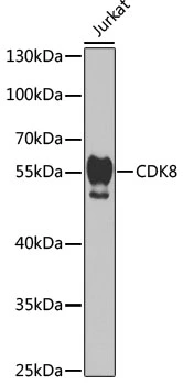 WB analysis of Jurkat cell lysate using GTX33086 CDK8 antibody. Dilution : 1:1000 Loading : 25microg per lane