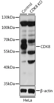 WB analysis of normal (control) and knockout (KO) HeLa cell lysate using GTX33086 CDK8 antibody. Dilution : 1:1000 Loading : 25microg per lane