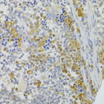 IHC-P analysis of rat spleen tissue using GTX33095 CIKS antibody. Dilution : 1:100
