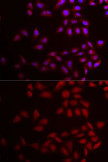 ICC/IF analysis of HeLa cells using GTX33096 CIRBP antibody. Blue : DAPI