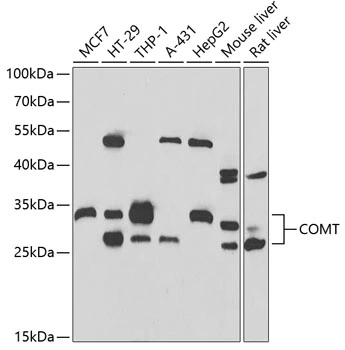 WB analysis of various sample lysates using GTX33108 COMT antibody. Dilution : 1:1000 Loading : 25microg per lane WB analysis of various sample lysates using GTX33108 COMT antibody. Dilution : 1:1000 Loading : 25microg per lane