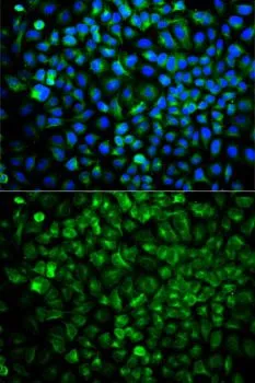 ICC/IF analysis of U2OS cells using GTX33108 COMT antibody. Blue : DAPI