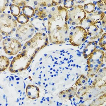 IHC-P analysis of mouse kidney tissue using GTX33108 COMT antibody. Dilution : 1:100