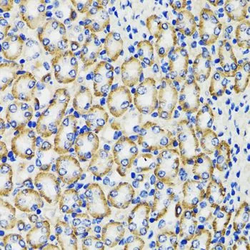 IHC-P analysis of rat kidney tissue using GTX33108 COMT antibody. Dilution : 1:100