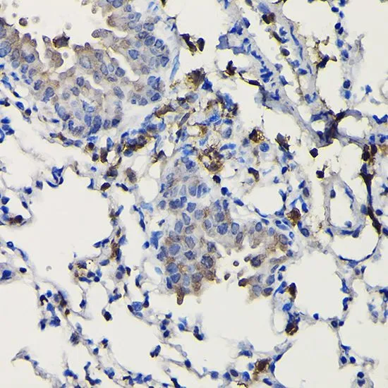 IHC-P analysis of mouse lung tissue using GTX33112 COTL1 antibody. Dilution : 1:100