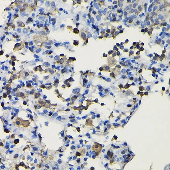 IHC-P analysis of rat lung tissue using GTX33112 COTL1 antibody. Dilution : 1:100