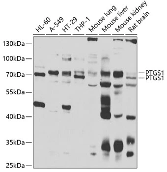 WB analysis of various sample lysates using GTX33113 COX1 antibody. The signal was developed with ECL plus-Enhanced. Dilution : 1:1000 Loading : 25microg per lane WB analysis of various sample lysates using GTX33113 COX1 antibody. The signal was developed with ECL plus-Enhanced. Dilution : 1:1000 Loading : 25microg per lane