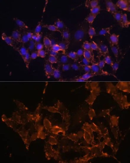 ICC/IF analysis of HeLa cells using GTX33113 COX1 antibody. Blue : DAPI Dilution : 1:100