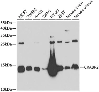 WB analysis of various sample lysates using GTX33118 CRABP2 antibody. The signal was developed with ECL plus-Enhanced. Dilution : 1:1000 Loading : 25microg per lane WB analysis of various sample lysates using GTX33118 CRABP2 antibody. The signal was developed with ECL plus-Enhanced. Dilution : 1:1000 Loading : 25microg per lane