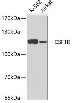 WB analysis of various samples using GTX33122 M-CSF Receptor antibody. Dilution : 1:500 Loading : 25ug per lane