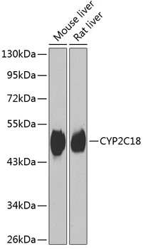 WB analysis of various sample lysates using GTX33135 CYP2C18 antibody. Dilution : 1:1000 Loading : 25microg per lane WB analysis of various sample lysates using GTX33135 CYP2C18 antibody. Dilution : 1:1000 Loading : 25microg per lane