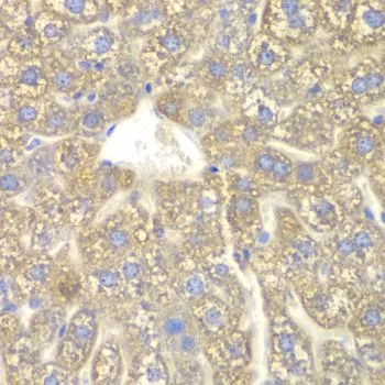 IHC-P analysis of mouse liver tissue using GTX33135 CYP2C18 antibody. Dilution : 1:100
