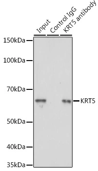 IP analysis of A431 cell lysate using GTX33140 Cytokeratin 5 antibody. Antibody amount : 3microg / 200microg lysate Dilution : 1:5000 IP analysis of A431 cell lysate using GTX33140 Cytokeratin 5 antibody. Antibody amount : 3microg / 200microg lysate Dilution : 1:5000