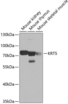 WB analysis of various sample lysates using GTX33140 Cytokeratin 5 antibody. Dilution : 1:500 Loading : 25microg per lane