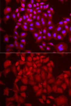 ICC/IF analysis of MCF7 cells using GTX33146 DCAF7 antibody. Blue : DAPI