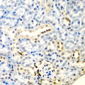 IHC-P analysis of mouse kidney tissue using GTX33147 DCTD antibody. Dilution : 1:200