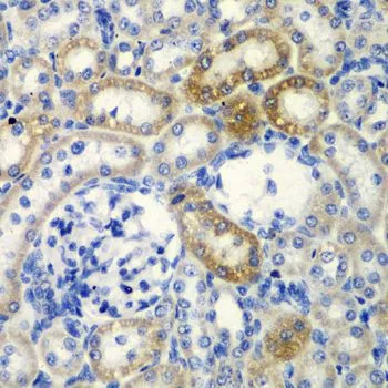 IHC-P analysis of rat kidney tissue using GTX33147 DCTD antibody. Dilution : 1:200