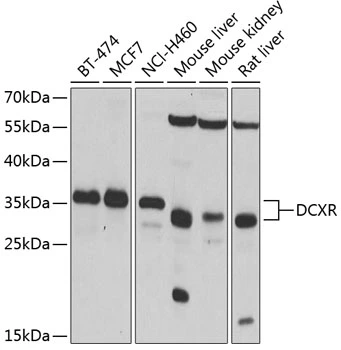 WB analysis of various sample lysates using GTX33148 DCXR antibody. Dilution : 1:1000 Loading : 25microg per lane WB analysis of various sample lysates using GTX33148 DCXR antibody. Dilution : 1:1000 Loading : 25microg per lane