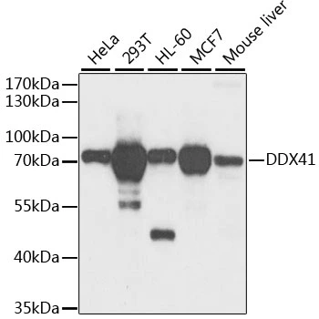 WB analysis of various sample lysates using GTX33151 DDX41 antibody. Dilution : 1:1000 Loading : 25microg per lane