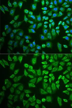 ICC/IF analysis of U2OS cells using GTX33151 DDX41 antibody. Blue : DAPI