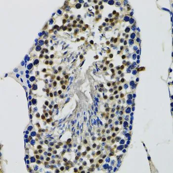 IHC-P analysis of mouse testis tissue using GTX33151 DDX41 antibody. Dilution : 1:100