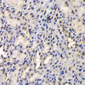 IHC-P analysis of rat kidney tissue using GTX33151 DDX41 antibody. Dilution : 1:100