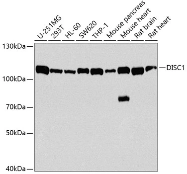 WB analysis of various sample lysates using GTX33154 DISC1 antibody. Dilution : 1:1000 Loading : 25microg per lane WB analysis of various sample lysates using GTX33154 DISC1 antibody. Dilution : 1:1000 Loading : 25microg per lane