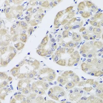 IHC-P analysis of human stomach tissue using GTX33154 DISC1 antibody. Dilution : 1:100
