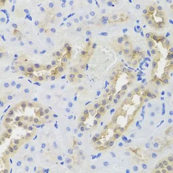 IHC-P analysis of rat kidney tissue using GTX33154 DISC1 antibody. Dilution : 1:100