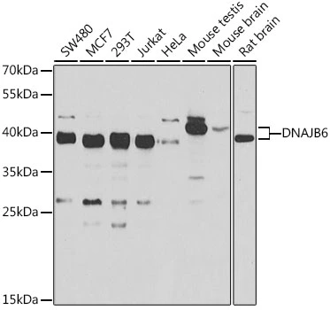 WB analysis of various sample lysates using GTX33160 DNAJB6 antibody. Dilution : 1:1000 Loading : 25microg per lane WB analysis of various sample lysates using GTX33160 DNAJB6 antibody. Dilution : 1:1000 Loading : 25microg per lane