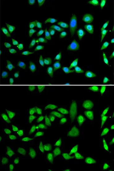 ICC/IF analysis of U2OS cells using GTX33160 DNAJB6 antibody. Blue : DAPI