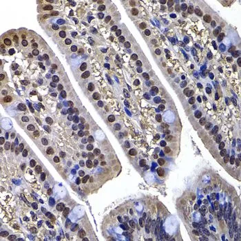 IHC-P analysis of mouse ileum tissue using GTX33160 DNAJB6 antibody. Dilution : 1:100