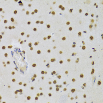 IHC-P analysis of rat testis tissue using GTX33161 DNMT3A antibody. Dilution : 1:100