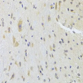 IHC-P analysis of rat spinal cord tissue using GTX33164 DPP3 antibody. Dilution : 1:100