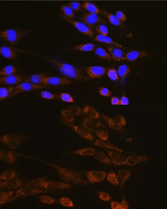 ICC/IF analysis of NIH/3T3 cells using GTX33165 Dynamin 2 antibody. Blue : DAPI Dilution : 1:100